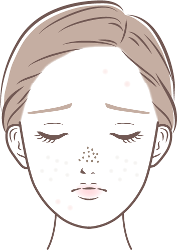 キュアジェット